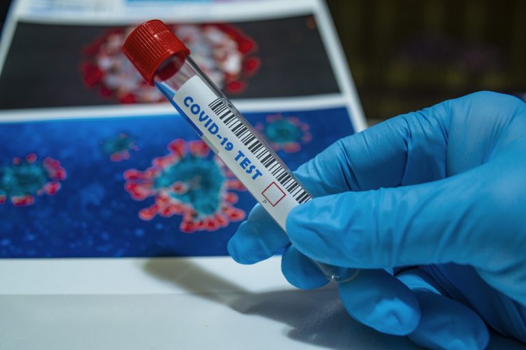 COVID-19, PARERI DISCORDANTI TRA GLI ESPERTI. RISCHIO SECONDA ONDATA? INTANTO LA VERITA’ E’ CHE…